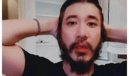 秃头最新爆料,揭秘明星脱发背后的真相